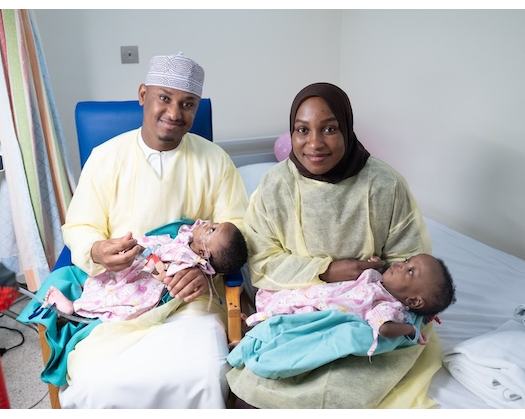 Oman Achieves Historic Conjoined Twin Separation