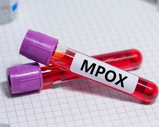 South Africa Reports Second Mpox Death This Week