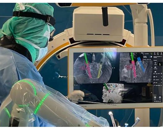 University Medical City Pioneers Advanced Spinal Surgery Techniques